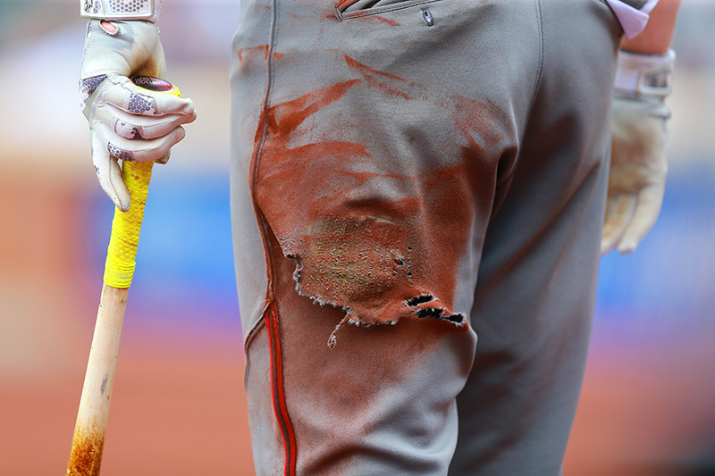 The torn pants of Arizona Diamondbacks Brandon Drury as he stands on deck in the fifth inning of a baseball game against the New York Mets at Citi Field in New York, Aug. 11, 2016. (Gordon Donovan)